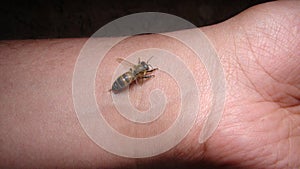 Bee : apis mellifera treatment by honey bee sting closeup honey bee stinging a hand close up bee worker insects, insect, animal, w