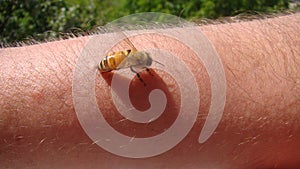 Bee : apis mellifera. treatment by honey bee sting closeup honey bee stinging a hand. close up bee worker . insects, insect, anima