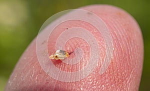 A bee stung a mans finger._