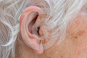 Behind The Ear hearing aid being worn by pensioner.