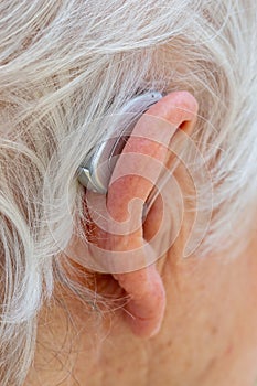 Behind The Ear hearing aid being worn by pensioner.