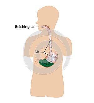 Belching. Air in the stomach. The structure of the esophagus and stomach. Infographics. Vector illustration