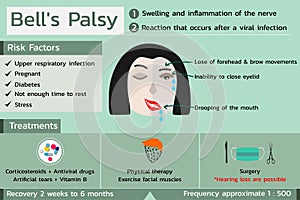 Bell\'s Palsy infographic in green color tone