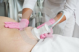 Belly cavitation at modern beauty clinic photo