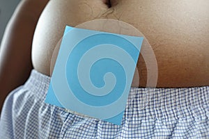 Belly of a fat man with blue post note paper sticker