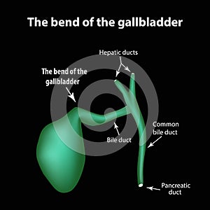 The bend of the gallbladder. Pathology of the gallbladder. Cholecystitis. The structure of the gallbladder. Infographics
