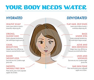 Benefits of drinking water.
