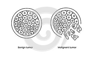 Benign and malignant tumor line icon in vector, illustration of oncology.