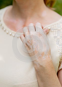 Benign pigmentation of the skin of the hands. White-brown leather. Melasma.