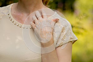 Benign pigmentation of the skin of the hands. White-brown leather. Melasma.