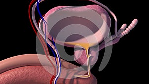 Benign prostatic hyperplasia