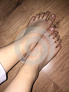 Foot pics