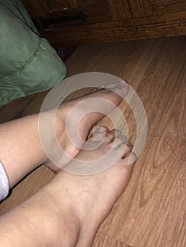 Foot pics