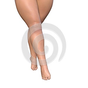 Big fat overweight obese young woman body, cellulite female legs