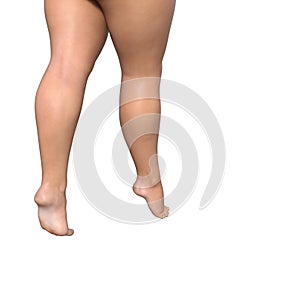 Big fat overweight obese young woman body, cellulite female legs