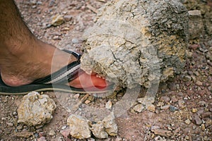 A big rock fall over the man`s foot.