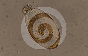 Big size Fasciola parasite egg.