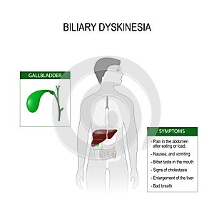 Biliary dyskinesia. Vector illustration for medical use