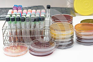 Biochem test kit for identified pathogen.