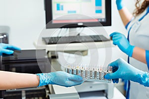 Biochemical analysis of blood. Hands of laboratory assistant loading sample tubes before loading to biochemical analyzer