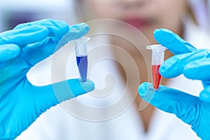 Biochemical analysis and Chemical analysis in Lab.