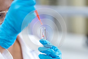 Biochemical analysis and Chemical analysis in Lab.