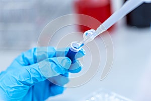 Biochemical analysis and Chemical analysis in Lab.