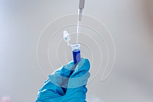 Biochemical analysis and Chemical analysis in Lab.