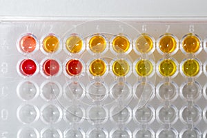 Biochemical analysis and Chemical analysis in Lab.