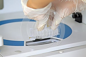 biochemical analyzer test in centers for disease control