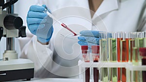 Biochemical research of blood, lab assistant doing microbiological analysis