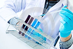 Biochemistry laboratory research, Chemist is analyzing sample in
