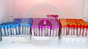 Biochemistry laboratory researchment. Plastic tubes for blood diagnostic. photo