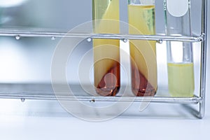 Biodiesel production is the process of producing the biofuel, biodiesel.