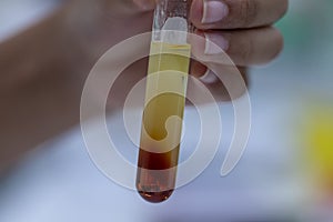 Biodiesel production is the process of producing the biofuel, biodiesel.