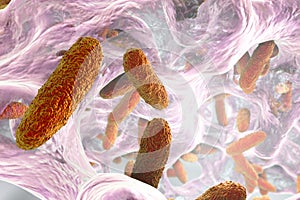 Biofilm of Klebsiella bacteria photo