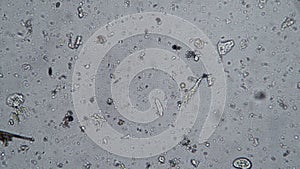 Biological background from a microcosm with protozoan microorganisms on a white background