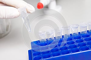 Biological solution in eppendorf