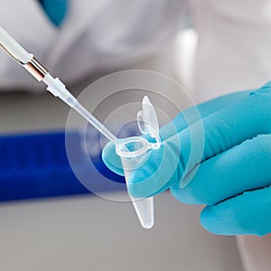 Biological solution in eppendorf