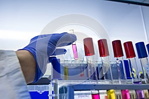 Biologist holding test tube with chemicals