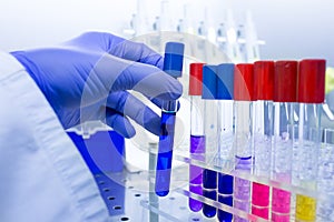 Biologist holding test tube with chemicals