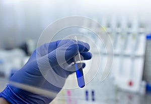 Biologist holding test tube with chemicals