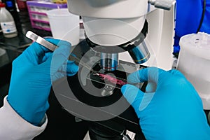 Biologist working in the laboratory microscope