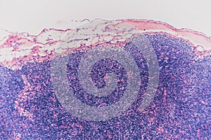 Biology abstract- cell lymph node dog