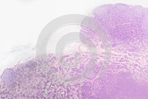 Biology abstract- cell lymph node dog photo