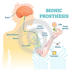 Bionic prosthesis - robotic female hand photo