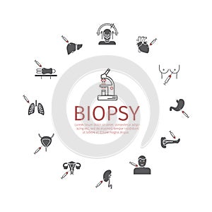 Biopsy: Types of biopsy procedures used to diagnose cancer