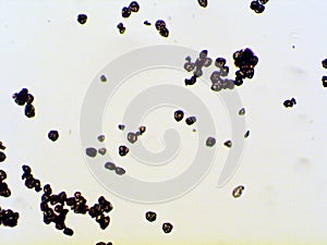 Birch Pollen seen in a microscope. They are small, it would take 40-50 pollens in a single line to reach one millimeter