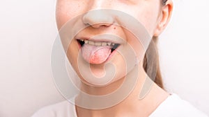birthmarks on surface face teen girl show tongue over white paint wall texture