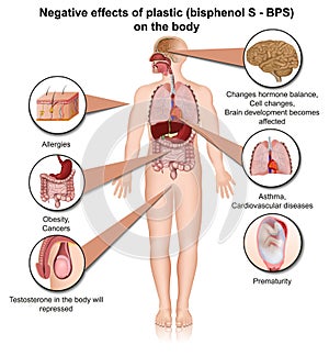 Bisphenol s effects on the human body 3d medical vector illustration isolated on white background